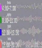 EEG alpha theta beta
